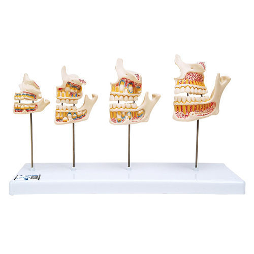 Anatomisches Modell / Kiefer - D20 - 3B Scientific   - Zahn / für die Ausbildung