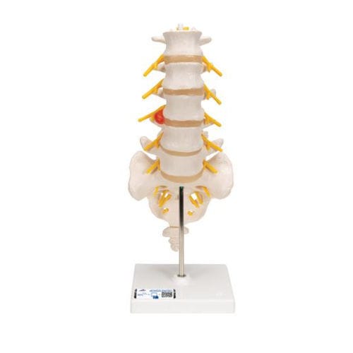 Lendenwirbelsäule anatomisches Modell - A76/5 - 3B Scientific   - Kreuzbein / für die Ausbildung
