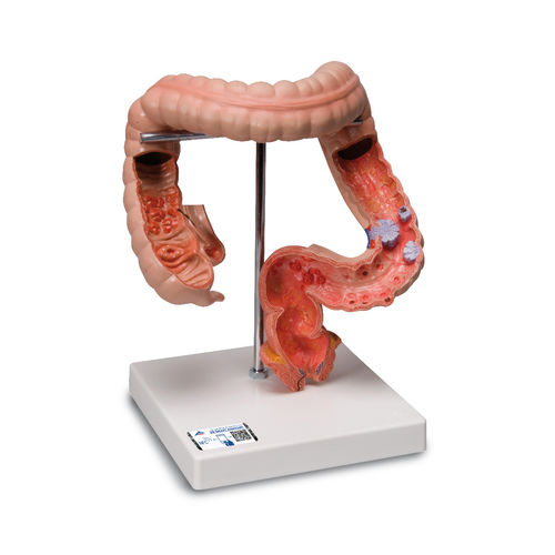 Anatomisches Modell / Dickdarm - K55 - 3B Scientific   - für die Ausbildung