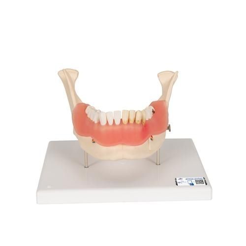Anatomisches Modell / Kiefer - D26 - 3B Scientific   - Zahn / für die Ausbildung