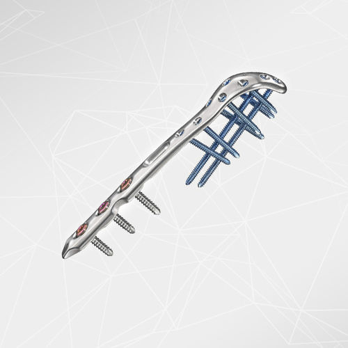 Kompressionsplatte für Olekranon - LOQTEQ® 2.7 - aap Implantate - mit Verriegelung / Metall