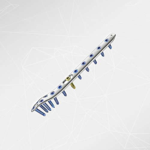 Kompressionsplatte für Fibula -  LOQTEQ® 3.5 - aap Implantate - distal / seitlich / mit Verriegelung