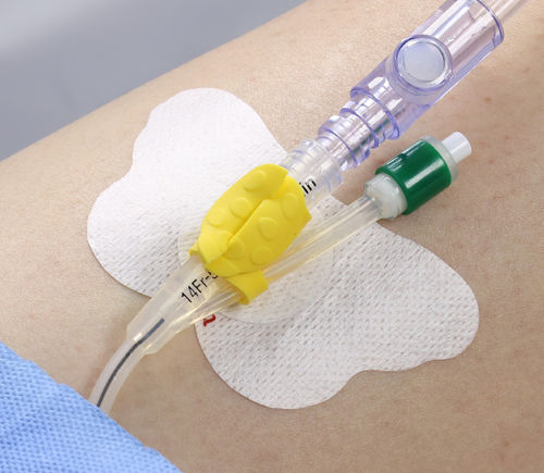 Fixierung für Urindrainage-Katheter - Wing Grip Foley - ACE Medical   - Bein / klebbar