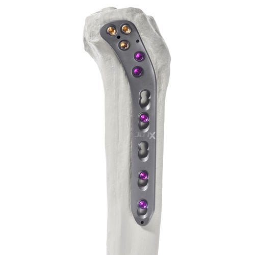 Kompressionsplatte für Tibia - 10-62603 - AF Medical   - proximal / seitlich / mit Verriegelung
