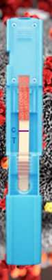 COVID-19-Testkit - Instant-view® PLUS - Alfa Scientific Designs - Antigene / SARS-COV-2 / Nasen-Rachenraum