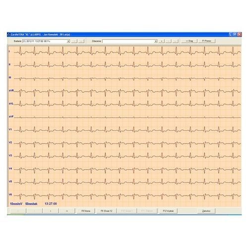 Elektrokardiografie-Software - CARDIOTEKA v.211SOFTHL7 - ASPEL  - Viewer / Herz / Online