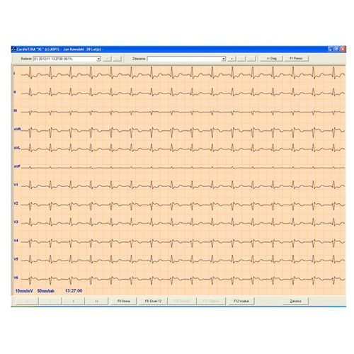 Elektrokardiografie-Software - CARDIOTEKA v.211SOFT - ASPEL  - Diagnose / Monitoring / Herz