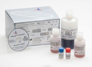 Syphilis-Schnelltest - FTPHA200 - Axis-Shield PLC  - Treponema pallidum / Serum / Plasma