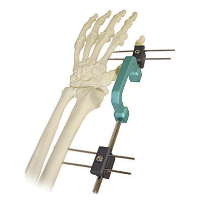 Fixateur externe / für Handgelenk - 568 - BAUMER  - rohrförmig / für Erwachsene