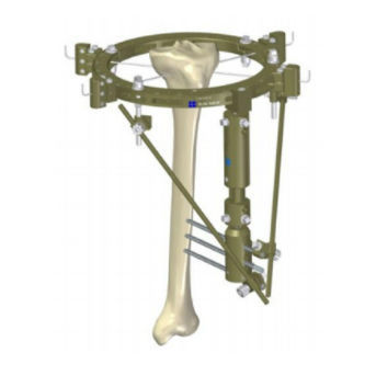 Fixateur externe / für Tibia - 549.10 - BAUMER  - hybrid / für Erwachsene