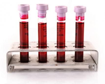 Plasma-Reagenz - SHK256-4G - BBI Enzymes  - für Forschungszwecke / VHB / menschliche Herkunft
