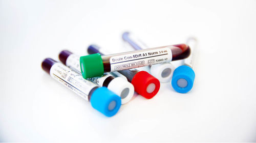 Reagenz / als Lösung - 150 series - Boule Medical - zur Qualitätskontrolle / Labor