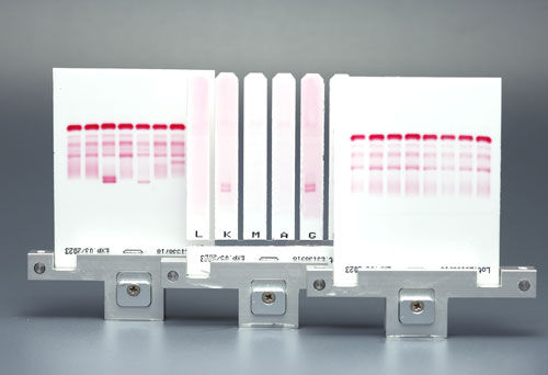 Serum-Reagenz - CELL - Start Project  - Antiserum / für Elektrophorese / Diagnose