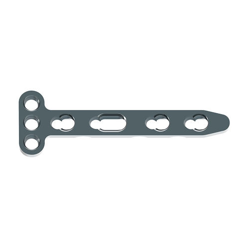 Kompressionsplatte für Radius - 70904 series - Waston medical - distal / mit Verriegelung / Titan