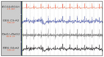Medizinische Software - ECG Free - Compumedics - Elektrokardiografie