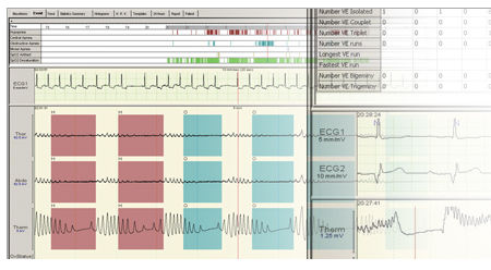 Diagnose-Software - Compumedics - Monitoring / für Polysomnografie