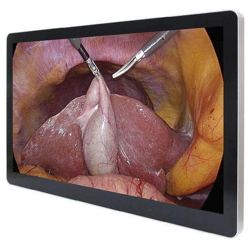 Medizinisch Monitor - ECONT-0501.1 - Contact Co. - OP / Full HD / 23,8"
