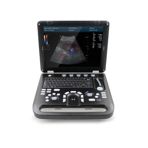 Tragbares Ultraschallgerät - CMS1700C  - Contec Medical Systems - für Ultraschalldiagnostik in Gynäkologie und Geburtshilfe / für bildgebende Ultraschalldiagnostik im Bauch- und Beckenbereich / Farbdoppler