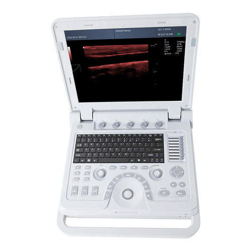 Tragbares Ultraschallgerät - CMS600P2PLUS - Contec Medical Systems - für Ultraschalldiagnostik in Gynäkologie und Geburtshilfe / für bildgebende Ultraschalldiagnostik im Bauch- und Beckenbereich / für urologische Diagnostik