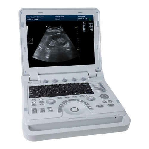 Tragbares Tierärztliches Ultraschallsystem - CMS1700A-VET - Contec Medical Systems - Multifunktion / Schwarz-Weiß / Farbdoppler