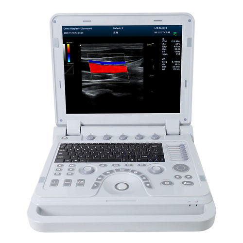 Tragbares Ultraschallgerät - CMS1700A  - Contec Medical Systems - für Multifunktions-Ultraschall / für Ultraschalldiagnostik in Gynäkologie und Geburtshilfe / für bildgebende Ultraschalldiagnostik im Bauch- und Beckenbereich