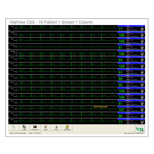 Patientenüberwachungsstation - VitalView® CSS - Criticare Systems - 16 Betten