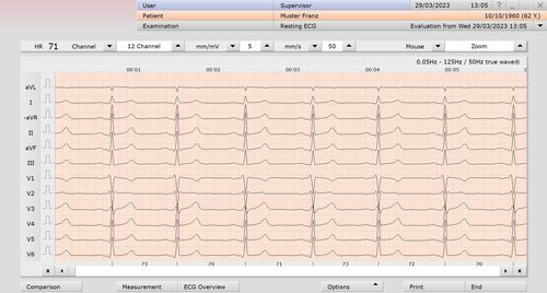 Software-Modul / Analyse - custo med GmbH - Mess / Diagnose / Elektrokardiografie