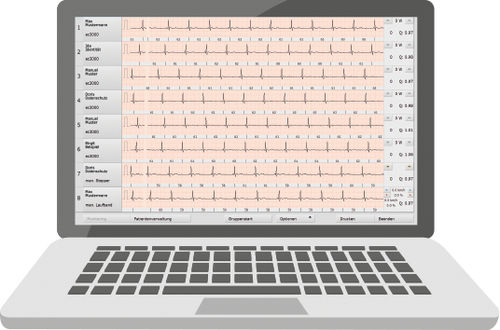 Rehabilitationssoftware - custo med GmbH - Monitoring / Steuerung / Herz