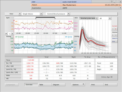 Software-Modul / Analyse - custo med GmbH - Diagnose / Bewertung / Aufzeichnung