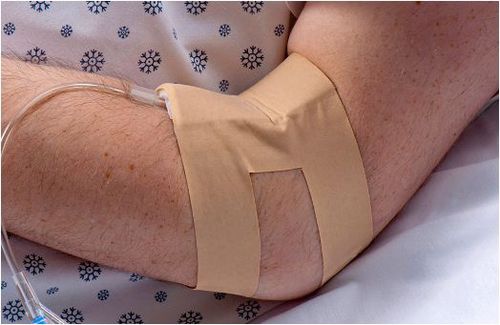 Fixierung für Intravenös-Katheter - IV-ARMOR®  - Dale Medical Products - Arm / klebbar