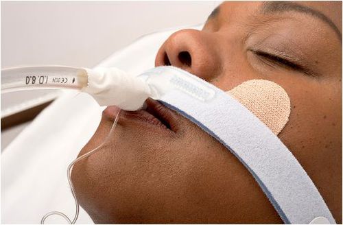 Fixierung für Luftröhrenschlauch - Stabilock - Dale Medical Products - Schädel / klebbar