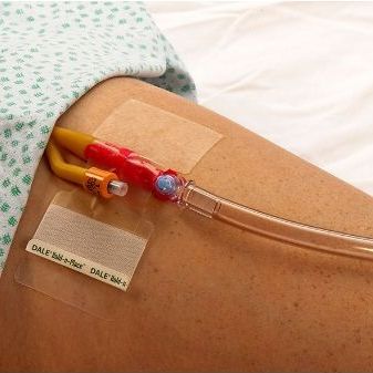 Fixierung für Urindrainage-Katheter - Hold-n-Place&reg; - Dale Medical Products - Bein / klebbar