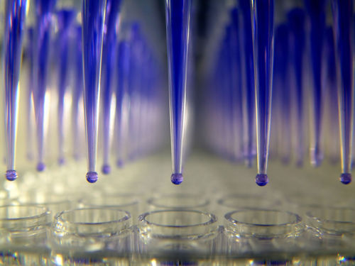 Enzyme-Reagenz - Dia.Pro Diagnostic Bioprobes  - Plasma / Diagnose / IgM