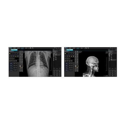 DICOM-Visualisierung-Software - DRGEM  - Druck / für Radiologie