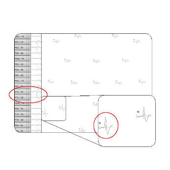 Visualisierungssoftware - Net Station 5.4  - Electrical Geodesics - Beschaffung / für Kliniken / EEG