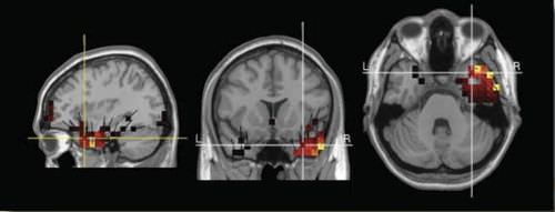Visualisierungssoftware - GeoSource 2.0 - Electrical Geodesics - medizinisch / EEG