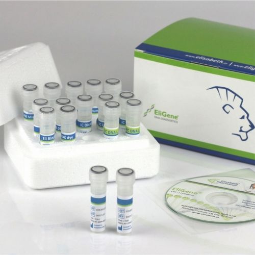 COVID-19-Testkit - 90078-RT - Elisabeth Pharmacon spol  - SARS-COV-2 / für Kliniken / Serum