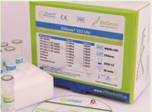 Testkit für Enzephalitis - EliGene® TBEV LC  - Elisabeth Pharmacon spol  - für Forschungszwecke / Viren / für Kliniken