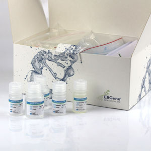 Reagenzkit / als Lösung - EliGene® - Elisabeth Pharmacon spol  - für Kliniken / für Speichelproben / für DNA-Extraktion