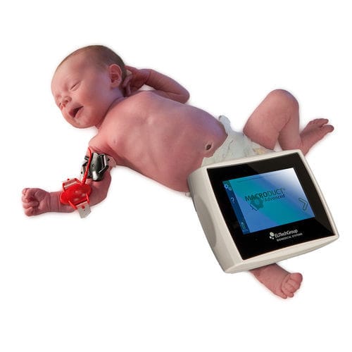 Analysegerät für zystische Fibrose / für Neugeborene - Macroduct® - ELITech Group  - mit Schweißtest