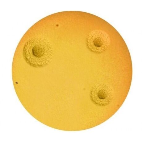 Agargel Reagenz - A7  - ELITech Group  - für Mykologie / Vitamin / Harnstoff