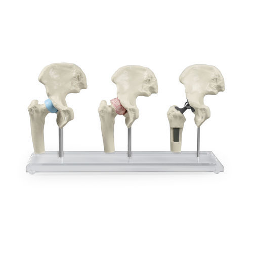 Hüfte anatomisches Modell - 1115 - Erler-Zimmer - Gelenk / für Implantologie / für orthopädische Chirurgie