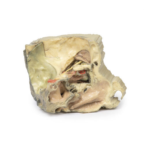Anatomisches Modell / Kopf - MP1685 - Erler-Zimmer - für die Ausbildung