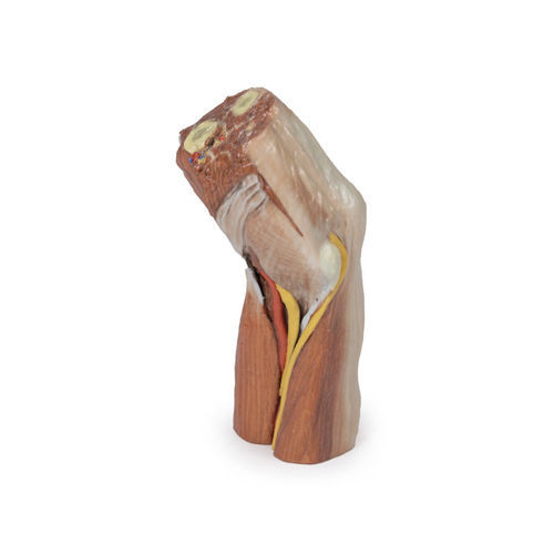 Anatomisches Modell / Arm - MP1755 - Erler-Zimmer - für die Ausbildung