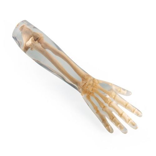 Testphantom für Röntgenzwecke - 7220 - Erler-Zimmer - Arm
