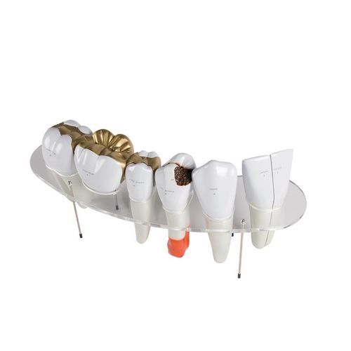 Anatomisches Modell / Zahn - R10125 - Erler-Zimmer - Dental / transparent
