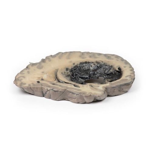 Anatomisches Gehirnmodell - MP2002 - Erler-Zimmer - Gehirn / Herz / mittlere Hirnarterie