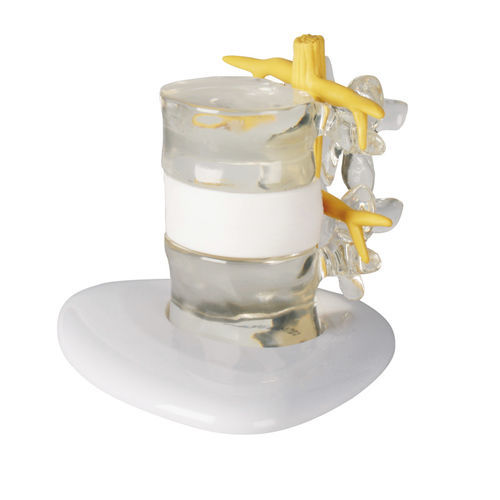 Anatomisches Modell / Lendenwirbel - 4400 - Erler-Zimmer - Wirbel / Ausbildung / transparent