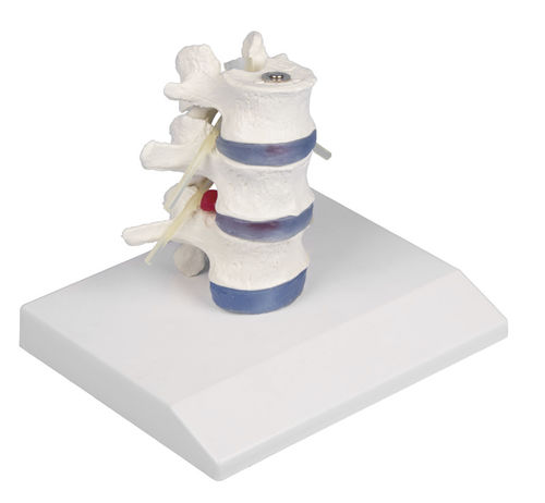 Anatomisches Modell / Rückenmark - 4047 - Erler-Zimmer - LWS / Bandscheibe