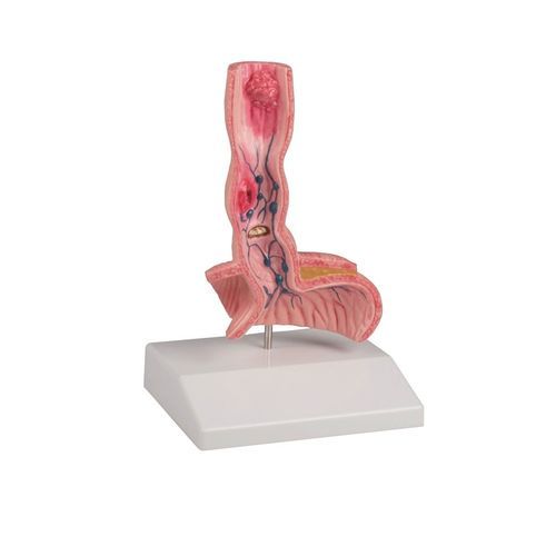 Anatomisches Modell / Speiseröhre - K218 - Erler-Zimmer